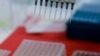 Brazil Declares Health Emergency Amid Avian Flu Cases in Wild Birds
