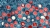 FILE - This image provided by the National Institute of Allergy and Infectious Diseases (NIAID) shows a colorized transmission electron micrograph of mpox particles (red) found within an infected cell (blue), cultured in a laboratory.