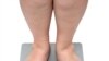 کاریگه‌ری قه‌ڵه‌وی به‌سه‌ر ته‌ندروستی مرۆڤ