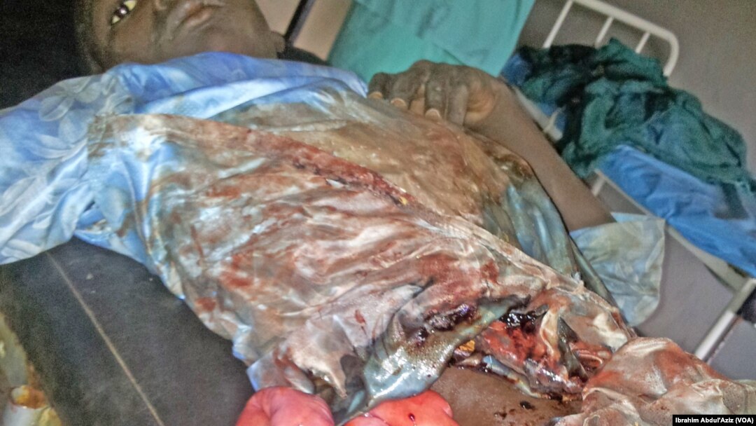Wasu mutane da suka ji raunuka bayan harin 'yan bindiga da ake zaton Boko Haram ne a kauyen Chakawa ran 26 ga watan Junairu, 2014.