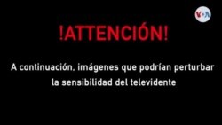 Un riñón de cerdo trasplantado en un humano desata el optimismo