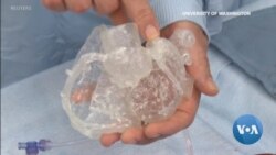 3D Heart Gives Surgeons Early Look at Patients