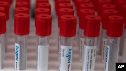 资料照片:强生公司的子公司比利时杨森制药公司有关新冠病毒研究的实验室桌面上摆放的试管。(2020年6月17日)