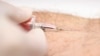 FILE - A nurse draws a blood sample for an HIV test.