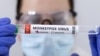 FILE - A test tube labeled "Monkeypox virus positive" is seen in this illustration made May 23, 2022. 