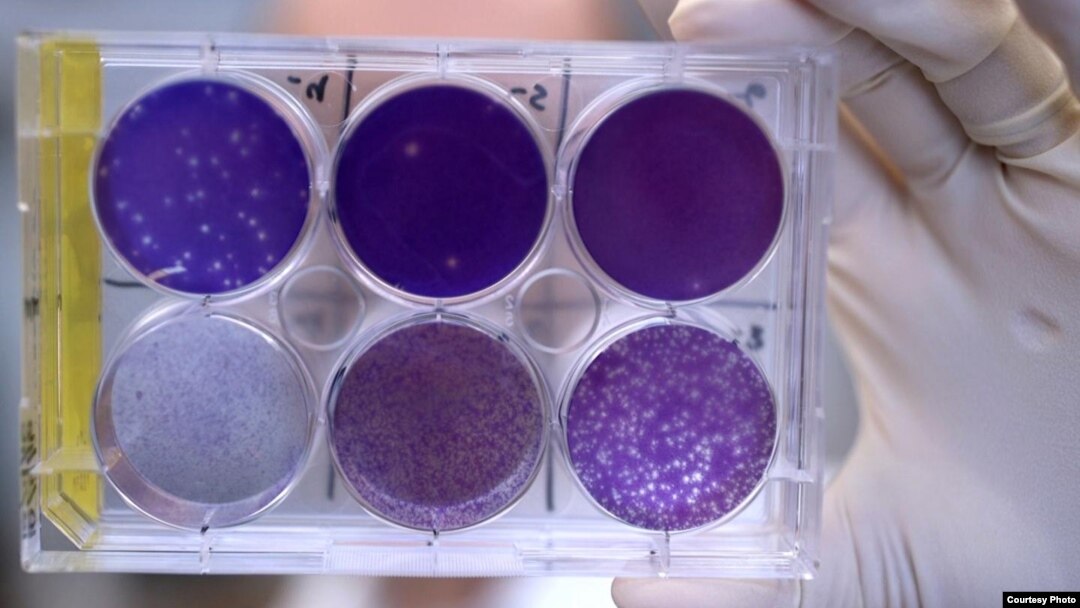 A researcher holds a tray of Zika virus growing in animal cells at Washington University School of Medicine in St. Louis, Missouri. Researchers have identified a human antibody that prevents, in pregnant mice, the fetus from becoming infected and the plac