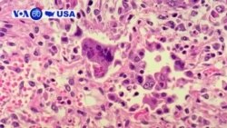 Manchetes Americanas 21 Maio 2019: Casos de sarampo aumentam nos EUA