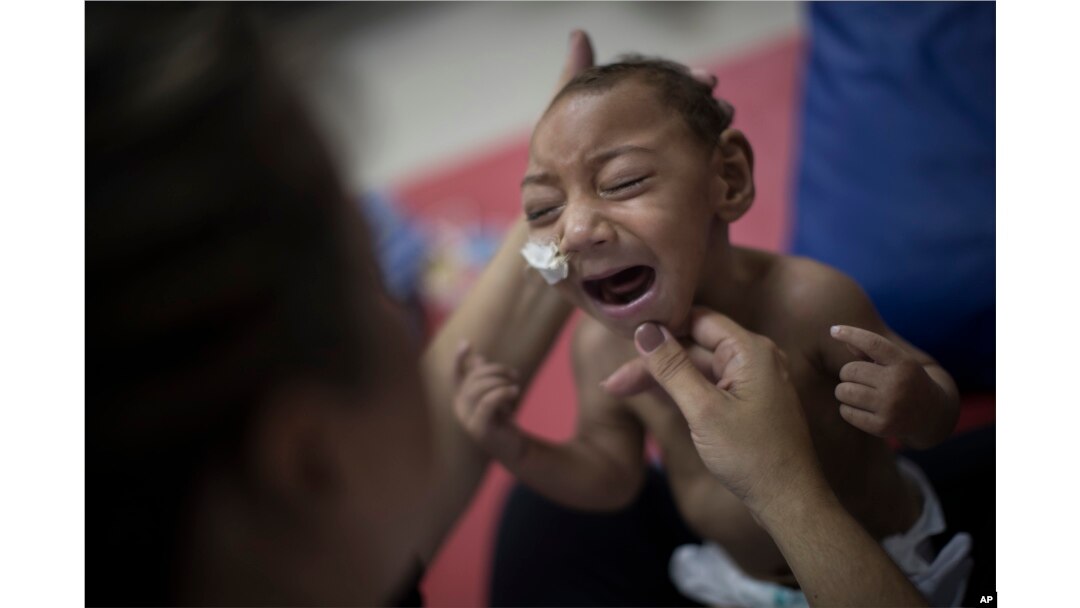 One-year-old Jose Wesley Campos, who was born with microcephaly, cries during a physical therapy session at the AACD rehabilitation center in Recife, Brazil, Sept. 28, 2016.