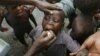 Child receiving polio vaccination (2004 photo)